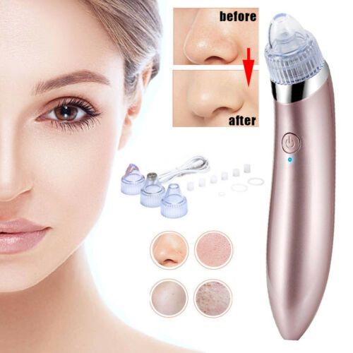 Blackhead Remover Electronic Vacuum Suction Facial Acne Pore Cleaner Extractor